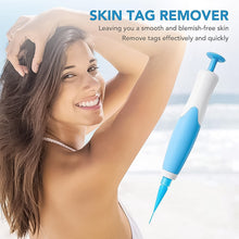 Portable Skin Tag Remover Kit